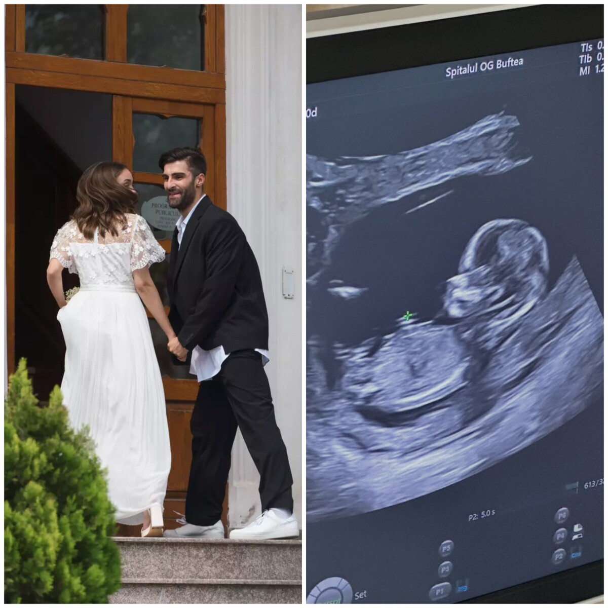 Surpriză în showbiz-ul din România! Actrița PRO TV a anunțat că este însărcinată cu primul copil: „O colaborare de succes pe perioadă nelimitată” Foto